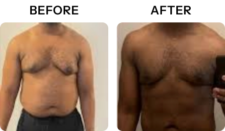 Michael's transformation - 7 inches lost in 5 ExoPod sessions for athletic performance