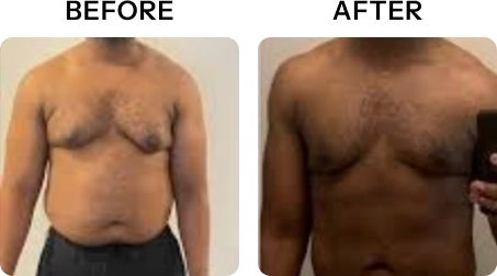 Michael's transformation - 7 inches lost in 5 ExoPod sessions for athletic performance